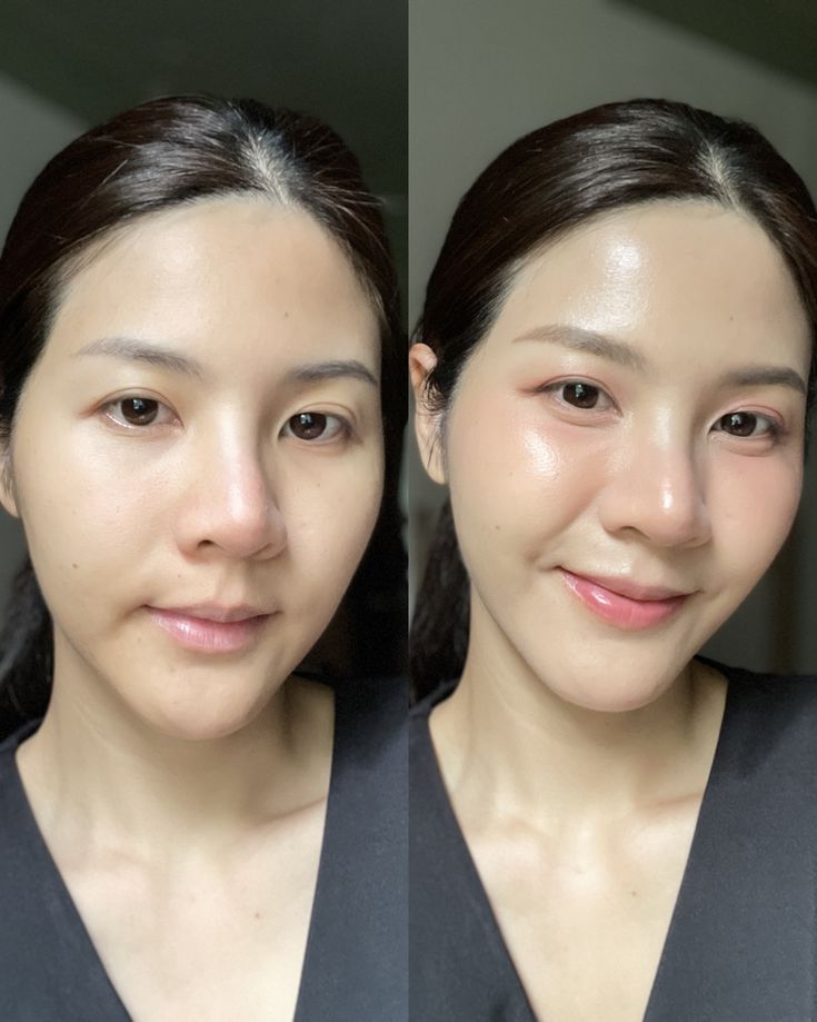 Why Personalized Skincare Treatments Deliver Better Results