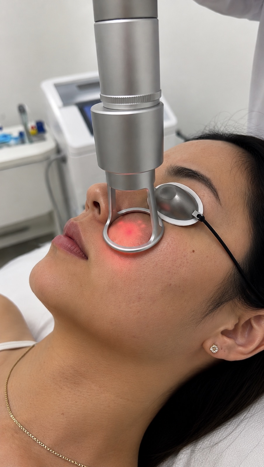 CO₂ Laser Facial